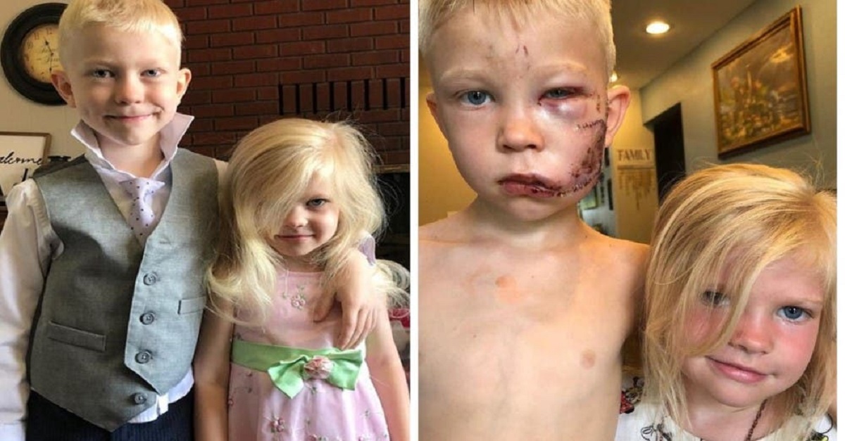 Menino de 6 anos salva sua irmãzinha do ataque de um cão